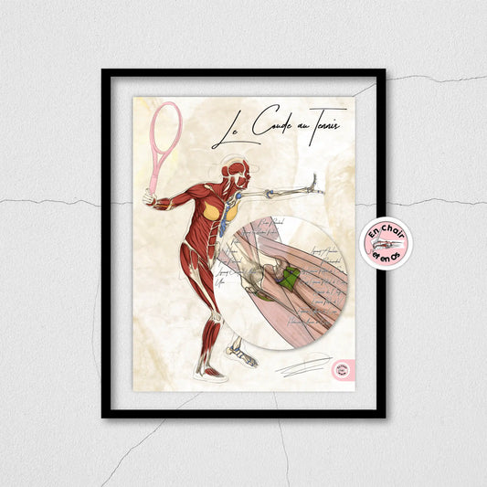 planche anatomique tennis muscles extenseur de l'avant bras 